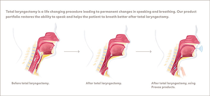 10 Best Clinics for Voice Restoration Surgery in San Sai [2023 Prices]